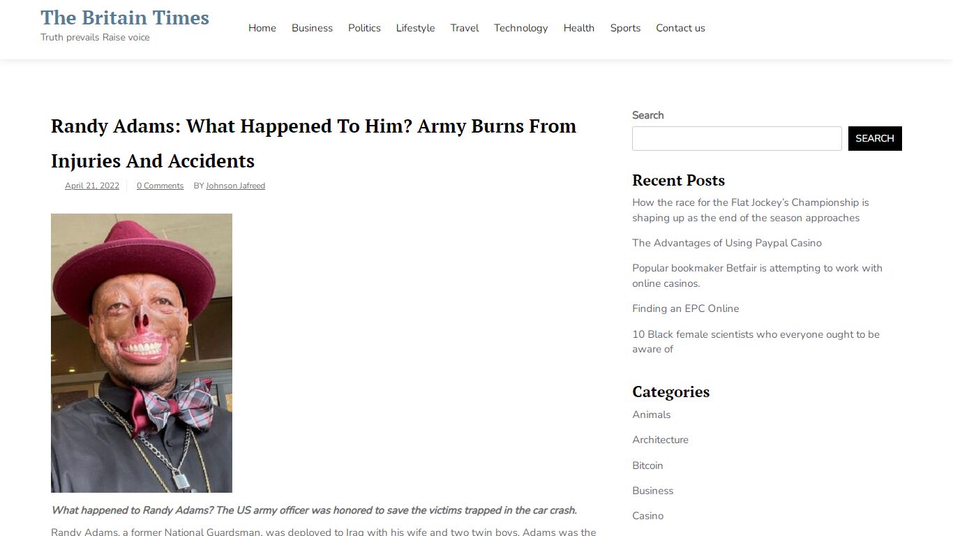 Randy Adams: What Happened To Him? Army Burns From Injuries And ...